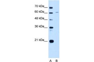 Western Blotting (WB) image for anti-Chromatin Licensing and DNA Replication Factor 1 (CDT1) antibody (ABIN2462973) (CDT1 antibody)