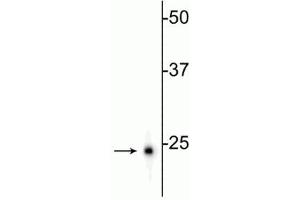 Western blot of rat hippocampal homogenate showing specific immunolabeling of the (UCHL1 antibody)