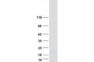 Validation with Western Blot (SPRR2E Protein (Myc-DYKDDDDK Tag))