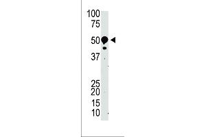 The anti-SUV39H2 Pab (ABIN388081 and ABIN2845969) is used in Western blot to detect SUV39H2 in mouse kidney tissue lysate. (SUV39H2 antibody  (N-Term))