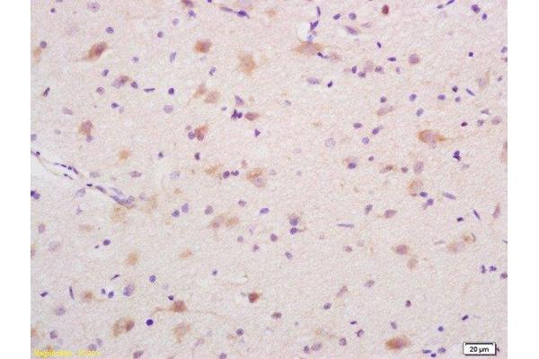DEDD antibody  (AA 151-250)