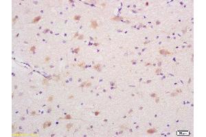 Formalin-fixed and paraffin embedded rat brain labeled with Rabbit Anti DEDD1 Polyclonal Antibody, Unconjugated  at 1:200 followed by conjugation to the secondary antibody and DAB staining