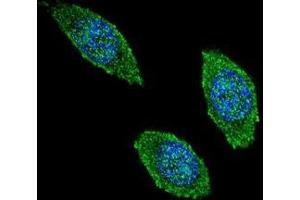 Confocal immunofluorescent analysis of CSF2 Antibody (Center) (Cat#AP51097PU-N) with 293 cell followed by Alexa Fluor 488-conjugated goat anti-rabbit lgG (green). (GM-CSF antibody  (Middle Region))