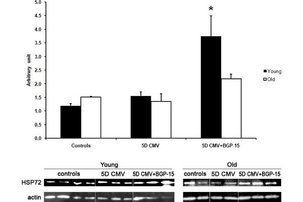 HSP70 antibody
