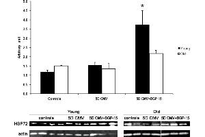 Western blot analyses of the Hsp72 protein expression normalized to actin contents in the diaphragm in control animals (individual rats: young n = 4 and old emphn = 2) compared with the age-matched animals exposed to CMV for 5 days with (individual rats: young n = 3 and old n = 2) and without BGP-15 (individual rats: young n = 3 and old n = 3).
