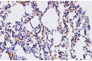Immunohistochemistry of paraffin-embedded Mouse lung using HPGD Polyclonal Antibody at dilution of 1:200 (HPGD antibody)