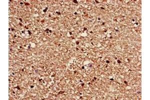 Immunohistochemistry of paraffin-embedded human brain tissue using ABIN7175571 at dilution of 1:100 (CACNG3 antibody  (AA 235-315))