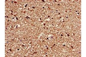 Immunohistochemistry of paraffin-embedded human brain tissue using ABIN7175571 at dilution of 1:100 (CACNG3 antibody  (AA 235-315))