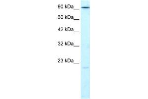 WB Suggested Anti-LIG4 Antibody Titration:  1. (LIG4 antibody  (N-Term))