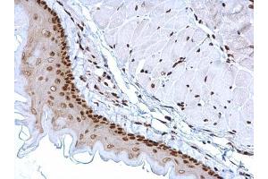 Immunohistochemistry (IHC) image for anti-High Mobility Group Box 1 (HMGB1) antibody (ABIN2854997)
