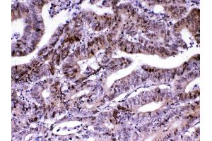 Immunohistochemistry (IHC) image for anti-Mediator Complex Subunit 18 (MED18) (AA 1-208) antibody (ABIN5519036)