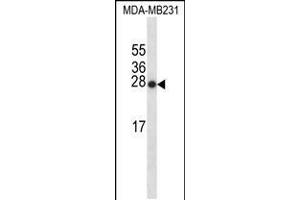 Western blot analysis in MDA-MB231 cell line lysates (35ug/lane). (SNX24 antibody  (AA 86-113))