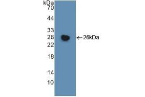 Detection of Recombinant GSTm1, Human using Polyclonal Antibody to Glutathione S Transferase Mu 1 (GSTM1) (GSTM1 antibody  (AA 1-218))