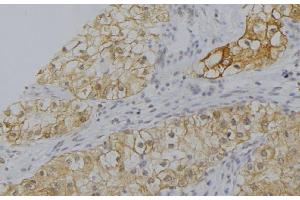 ABIN6277563 at 1/100 staining Human uterus tissue by IHC-P. (CFP antibody  (Internal Region))