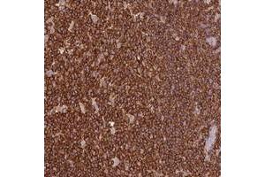 Immunohistochemical staining of human tonsil with OR6P1 polyclonal antibody  shows strong cytoplasmic positivity in germinal and non-germinal center cells at 1:20-1:50 dilution. (OR6P1 antibody)