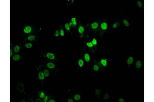 Immunofluorescence staining of HepG2 cells with ABIN7149488 at 1:100, counter-stained with DAPI. (DACT1 antibody  (AA 410-525))