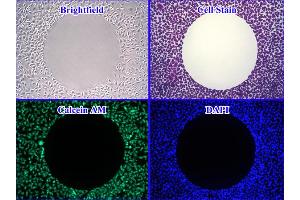 Cellular Assay (CA) image for Radius™ 24-Well Cell Migration Assay (ABIN2344873)