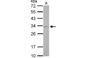 Western Blotting (WB) image for anti-Replication Protein A2, 32kDa (RPA2) antibody (ABIN2856881)