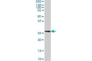 PROSC MaxPab polyclonal antibody. (PROSC antibody  (AA 1-275))