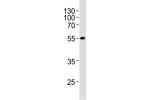 Western blot analysis of lysate from WiDr cell line using PDX1 at 1:1000. (PDX1 antibody  (AA 429-459))