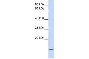 ZG16 antibody used at 1 ug/ml to detect target protein. (ZG16 antibody  (Middle Region))