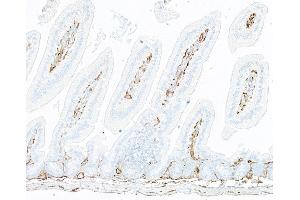 Immunohistochemistry (IHC) image for anti-Thrombomodulin (THBD) (AA 17-517) antibody (ABIN7795655) (Recombinant Thrombomodulin antibody  (AA 17-517))