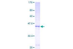 GPLD1 Protein (AA 1-176) (GST tag)