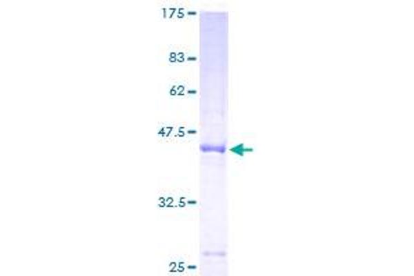 GPLD1 Protein (AA 1-176) (GST tag)