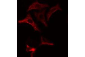 ABIN6274865 staining Hela cells by IF/ICC. (Arylsulfatase A antibody  (Internal Region))