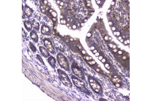 IHC testing of FFPE rat small intestine tissue with MVP antibody at 1ug/ml. (MVP antibody)