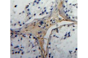 Immunohistochemistry (IHC) image for anti-Immunoglobulin lambda-Like Polypeptide 1 (IGLL1) (AA 29-201) antibody (ABIN2118554)