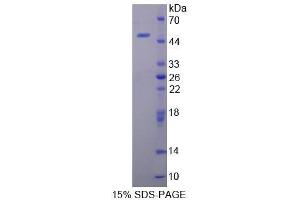 SDS-PAGE (SDS) image for Cathelicidin Antimicrobial Peptide (CAMP) (AA 31-172) protein (His tag,GST tag) (ABIN2122565) (Cathelicidin Protein (AA 31-172) (His tag,GST tag))