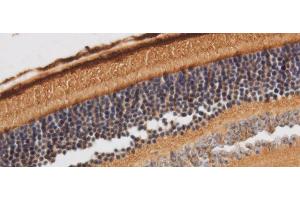 Immunohistochemistry of paraffin-embedded Rat retina using RBP3 Polyclonal Antibody at dilution of 1:50 (RBP3 antibody)