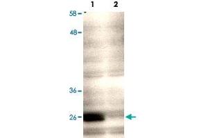 Western blot using CENPQ polyclonal antibody  shows detection of endogenous CENPQ in a HeLa whole cell lysate (Lane 1, arrowhead). (CENPQ antibody)