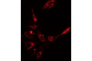 ABIN6266633 staining HepG2 cells by IF/ICC. (INPP5D antibody  (C-Term))