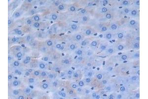 Detection of a2PI in Rat Liver Tissue using Polyclonal Antibody to Alpha 2-Antiplasmin (a2PI) (alpha 2 Antiplasmin antibody  (AA 348-491))