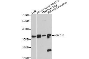 Western blot analysis of extracts of various cell lines, using ANXA13 antibody (ABIN6290067) at 1:3000 dilution. (Annexin A13 antibody)