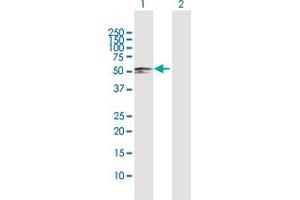 Western Blot analysis of SARS2 expression in transfected 293T cell line by SARS2 MaxPab polyclonal antibody. (SARS2 antibody  (AA 1-518))