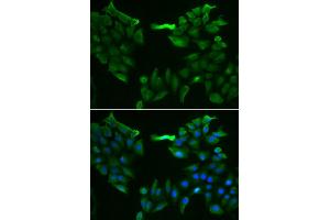 Immunofluorescence analysis of HeLa cell using SLC5A6 antibody. (SLC5A6 antibody)