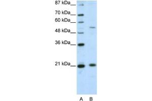 Western Blotting (WB) image for anti-Zinc Finger and SCAN Domain Containing 20 (ZSCAN20) antibody (ABIN2461978) (ZSCAN20 antibody)