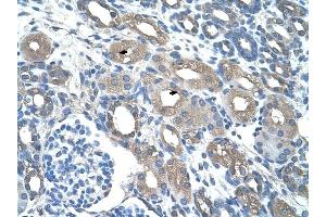 RSAD2 antibody was used for immunohistochemistry at a concentration of 4-8 ug/ml to stain Epithelial cells of renal tubule (arrows) in Human Kidney. (RSAD2 antibody  (C-Term))