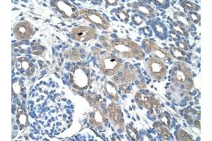 RSAD2 antibody was used for immunohistochemistry at a concentration of 4-8 ug/ml to stain Epithelial cells of renal tubule (arrows) in Human Kidney.