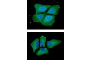 ICC/IF analysis of PKLR in Hep3B cells line, stained with DAPI (Blue) for nucleus staining and monoclonal anti-human PKLR antibody (1:100) with goat anti-mouse IgG-Alexa fluor 488 conjugate (Green). (PKLR antibody  (AA 47-574))