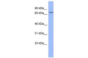 WB Suggested Anti-PATZ1  Antibody Titration: 0.