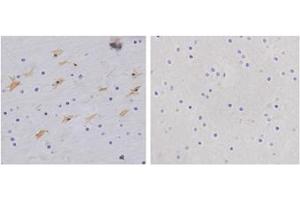 Immunohistochemistry analysis of human brain tissue slide (Paraffin embedded) using Rabbit Anti-GFAP Polyclonal Antibody (Left, ABIN398827) and Purified Rabbit IgG (Whole molecule) Control (Right, ABIN398653) (GFAP antibody  (AA 250-300))