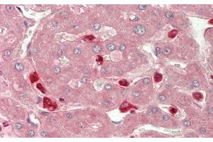 Immunohistochemistry (IHC) image for anti-Chitinase 3-Like 1 (Cartilage Glycoprotein-39) (CHI3L1) (AA 112-377) antibody (ABIN7433657)