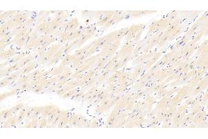 Detection of CRN in Human Cardiac Muscle Tissue using Polyclonal Antibody to Corin (CRN) (Corin antibody  (AA 807-1038))