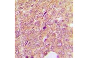 Immunohistochemistry (IHC) image for anti-Insulin-Like Growth Factor Binding Protein 3 (IGFBP3) antibody (ABIN7304020)