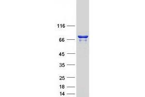 ATP-Binding Cassette, Sub-Family F (GCN20), Member 3 (ABCF3) protein (Myc-DYKDDDDK Tag)