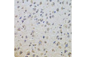 Immunohistochemistry (Paraffin-embedded Sections) (IHC (p)) image for anti-Epidermal Growth Factor Receptor (EGFR) (AA 1021-1210) antibody (ABIN6139974)